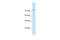 Solute Carrier Family 7 Member 1 antibody, 29-912, ProSci, Enzyme Linked Immunosorbent Assay image 