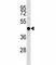 TNF Receptor Associated Factor 4 antibody, F44471-0.4ML, NSJ Bioreagents, Western Blot image 