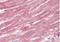 Actin Related Protein 2/3 Complex Subunit 1A antibody, NBP2-11579, Novus Biologicals, Immunohistochemistry paraffin image 