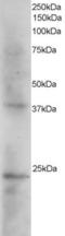 SET Nuclear Proto-Oncogene antibody, EB05148, Everest Biotech, Western Blot image 