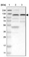 Zinc Finger SWIM-Type Containing 5 antibody, NBP1-93586, Novus Biologicals, Western Blot image 