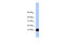 Profilin 1 antibody, 30-387, ProSci, Enzyme Linked Immunosorbent Assay image 