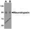 Serine Protease 12 antibody, 4105, ProSci, Western Blot image 