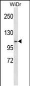 Zinc Finger Protein 836 antibody, PA5-48607, Invitrogen Antibodies, Western Blot image 