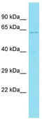 KAT8 regulatory NSL complex subunit 2 antibody, TA330659, Origene, Western Blot image 