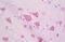 Casein Kinase 1 Epsilon antibody, MBS244304, MyBioSource, Immunohistochemistry frozen image 