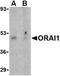 ORAI Calcium Release-Activated Calcium Modulator 1 antibody, NBP1-76762, Novus Biologicals, Western Blot image 