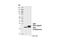Core-Binding Factor Subunit Beta antibody, 62184S, Cell Signaling Technology, Western Blot image 