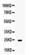 Fibroblast Growth Factor 1 antibody, PA5-79249, Invitrogen Antibodies, Western Blot image 