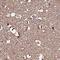 NAD(P)HX Epimerase antibody, PA5-60502, Invitrogen Antibodies, Immunohistochemistry paraffin image 