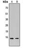 C-X-C Motif Chemokine Ligand 6 antibody, orb234859, Biorbyt, Western Blot image 