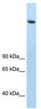 Lysine Demethylase 3B antibody, TA345209, Origene, Western Blot image 