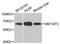 Methionyl Aminopeptidase 2 antibody, STJ111259, St John