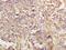 N-lysine methyltransferase SETD8 antibody, orb184546, Biorbyt, Immunohistochemistry paraffin image 