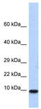 PHS antibody, TA335170, Origene, Western Blot image 