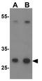 Neurogenin 2 antibody, GTX31509, GeneTex, Western Blot image 