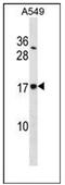 Signal Sequence Receptor Subunit 4 antibody, AP54053PU-N, Origene, Western Blot image 