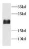 Histone H3 antibody, FNab03877, FineTest, Western Blot image 