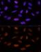 Activity Dependent Neuroprotector Homeobox antibody, GTX17559, GeneTex, Immunofluorescence image 