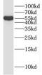 Importin subunit alpha-2 antibody, FNab04635, FineTest, Western Blot image 