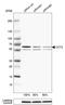 Chaperonin Containing TCP1 Subunit 3 antibody, HPA006543, Atlas Antibodies, Western Blot image 