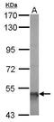Aldehyde Dehydrogenase 5 Family Member A1 antibody, GTX110181, GeneTex, Western Blot image 