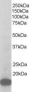 ARPC3 antibody, 45-294, ProSci, Western Blot image 