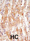 Mitogen-Activated Protein Kinase Kinase Kinase 6 antibody, 63-283, ProSci, Immunohistochemistry paraffin image 