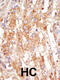 Mitogen-activated protein kinase kinase kinase 6 antibody, 63-283, ProSci, Immunohistochemistry paraffin image 