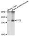 Stanniocalcin 2 antibody, abx126665, Abbexa, Western Blot image 