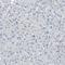 Aldehyde Dehydrogenase 18 Family Member A1 antibody, NBP1-83324, Novus Biologicals, Immunohistochemistry paraffin image 