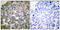 Phospholipase C Gamma 1 antibody, LS-C117571, Lifespan Biosciences, Immunohistochemistry paraffin image 