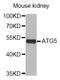 Autophagy Related 5 antibody, abx005472, Abbexa, Western Blot image 