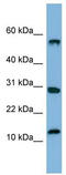 Signal Recognition Particle 19 antibody, TA345832, Origene, Western Blot image 