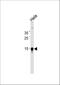 Cytidine Deaminase antibody, M01578, Boster Biological Technology, Western Blot image 