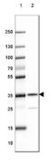 Rab Geranylgeranyltransferase Subunit Beta antibody, NBP1-85962, Novus Biologicals, Western Blot image 