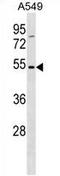 Transmembrane 6 Superfamily Member 1 antibody, AP54280PU-N, Origene, Western Blot image 