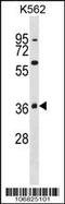 Mitogen-Activated Protein Kinase 11 antibody, 62-958, ProSci, Western Blot image 