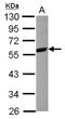 Mitogen-Activated Protein Kinase Kinase 7 antibody, NBP2-17272, Novus Biologicals, Western Blot image 