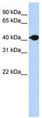 Deoxyribonuclease 2 Beta antibody, TA329458, Origene, Western Blot image 