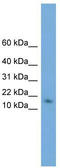 Ribonuclease UK114 antibody, TA340083, Origene, Western Blot image 