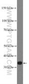 Protein Phosphatase 1 Regulatory Subunit 3B antibody, 27285-1-AP, Proteintech Group, Western Blot image 