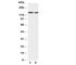 RB Transcriptional Corepressor Like 2 antibody, R30995, NSJ Bioreagents, Western Blot image 