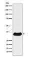 Galectin 4 antibody, M08468, Boster Biological Technology, Western Blot image 