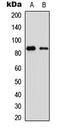 Olfactomedin Like 2B antibody, abx121453, Abbexa, Western Blot image 