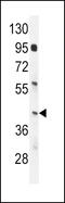 Interferon Regulatory Factor 9 antibody, MBS9209363, MyBioSource, Western Blot image 