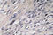 IRP1 antibody, LS-C176609, Lifespan Biosciences, Immunohistochemistry paraffin image 