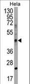 Chitinase Domain Containing 1 antibody, LS-C168734, Lifespan Biosciences, Western Blot image 