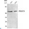 Coactivator Associated Arginine Methyltransferase 1 antibody, LS-C813095, Lifespan Biosciences, Western Blot image 