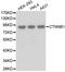 Catenin Beta 1 antibody, STJ29793, St John
